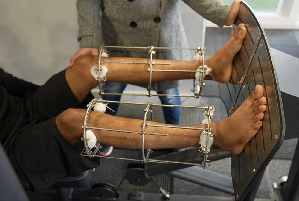 Specialist reviewing postoperative X-rays after limb lengthening